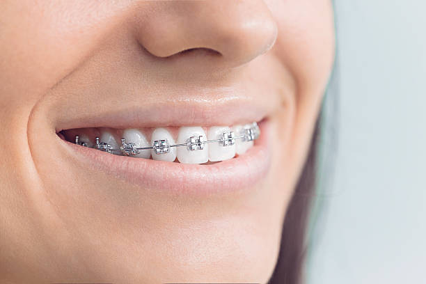 Best Invisalign and Clear Aligners  in , PA